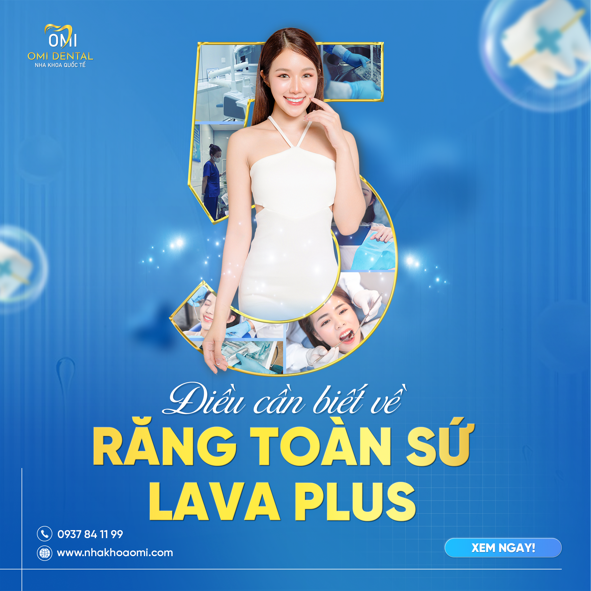 Răng sứ Lava Plus có tốt không? Có giá bao nhiêu?