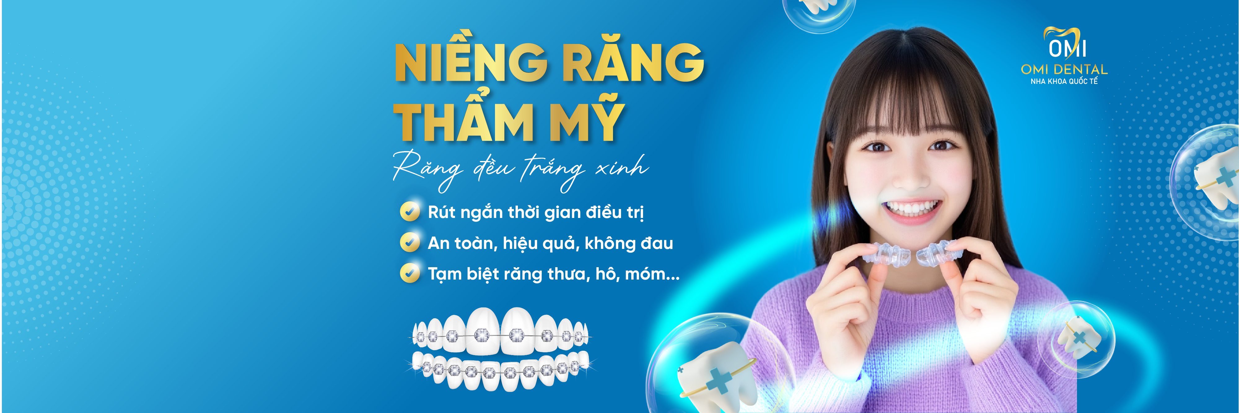 Thẩm mỹ niềng răng