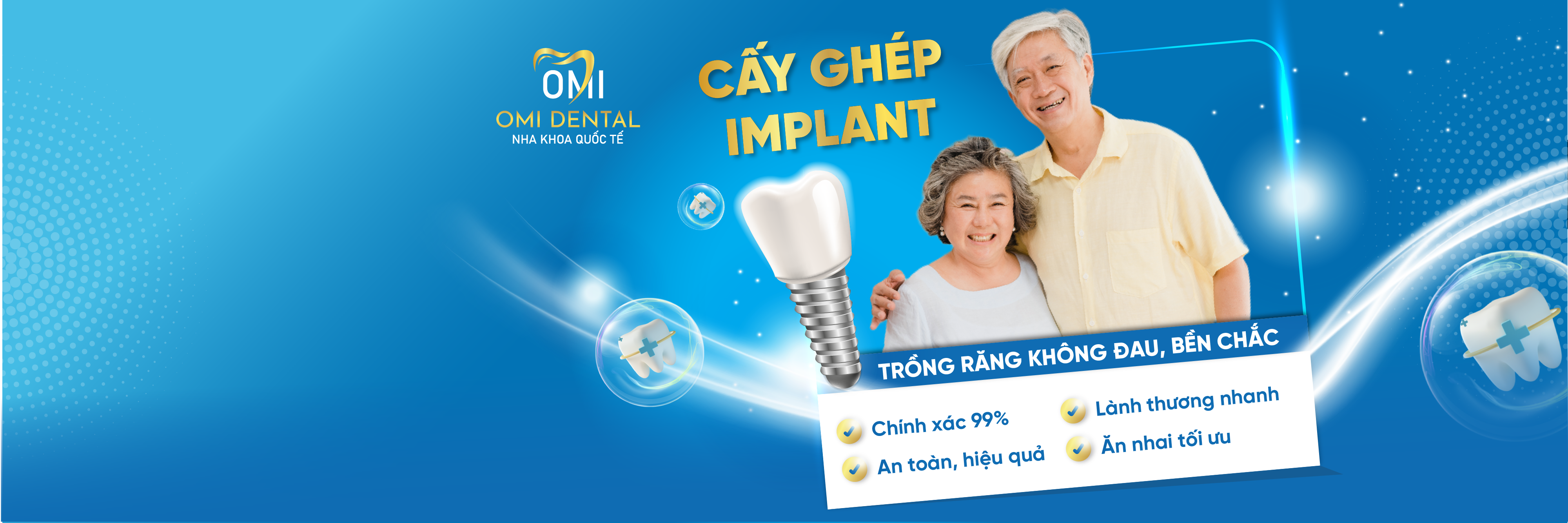Cấy ghép Implant