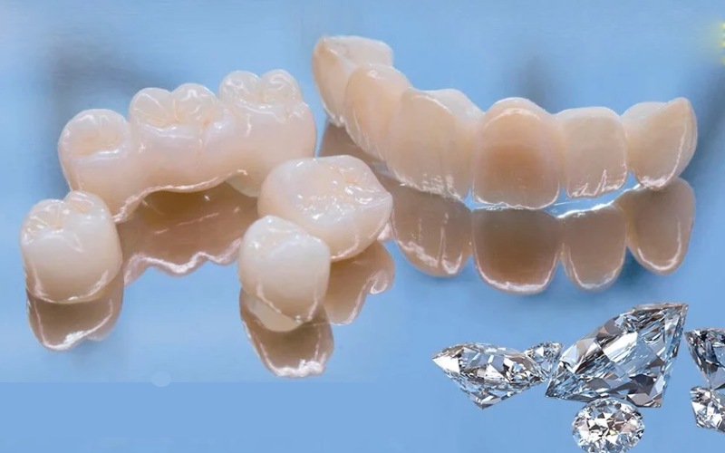 Răng toàn sứ Diamond có chế độ bảo hành lâu dài