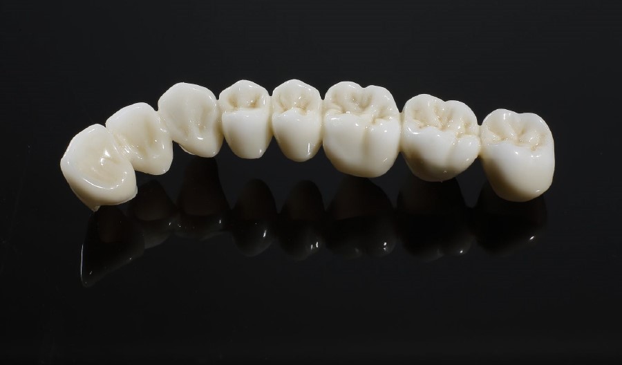 Răng sứ Venus được chế tác từ 100% chất liệu sứ nguyên khối