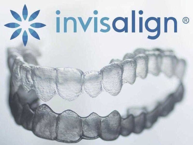 Niềng răng Invisalign mang tính thẩm mỹ cao