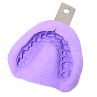 Cấy ghép Implant