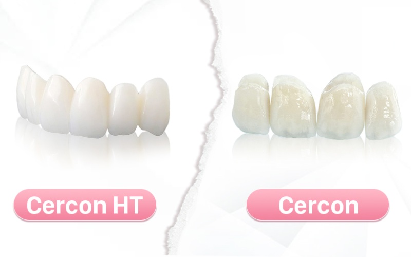 Răng sứ Cercon HT có những ưu thế vượt trội hơn răng sứ Cercon
