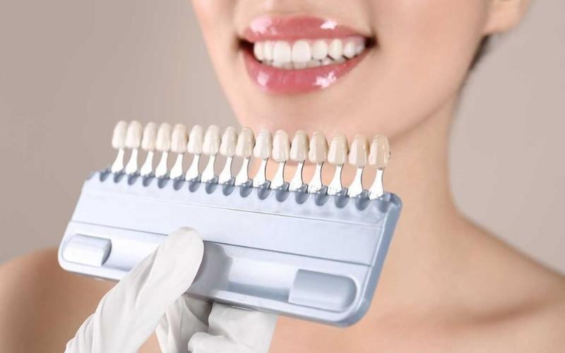 Răng sứ Cercon HT có đa dạng màu sắc, đáp ứng nhu cầu của nhiều khách hàng