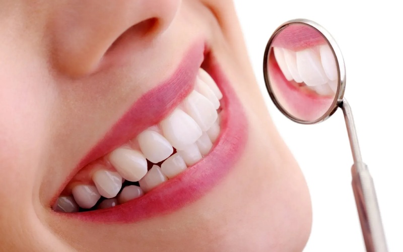 Răng sứ Cercon HT mang lại thẩm mỹ vượt trội