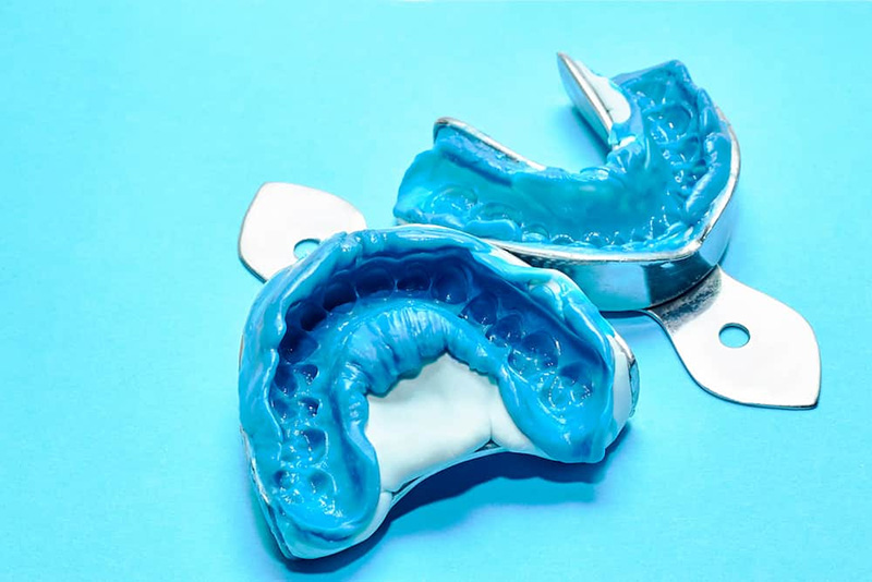 Thông qua các dụng cụ chuyên dụng, bác sĩ sẽ tiến hành lấy dấu răng và chuyển thông tin sang đơn vị chế tác răng sứ