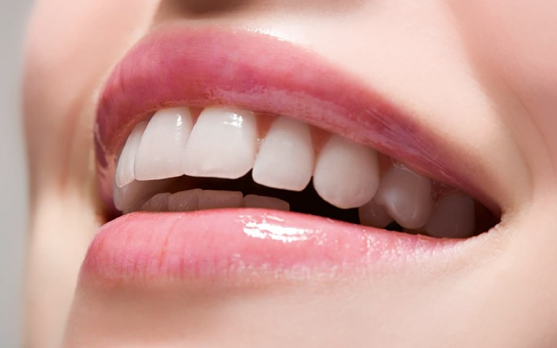 Răng sứ Zirconia HT được đánh giá rất cao về thẩm mỹ
