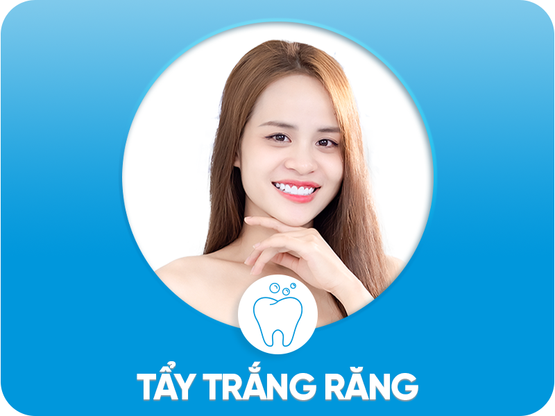 tay trang rang