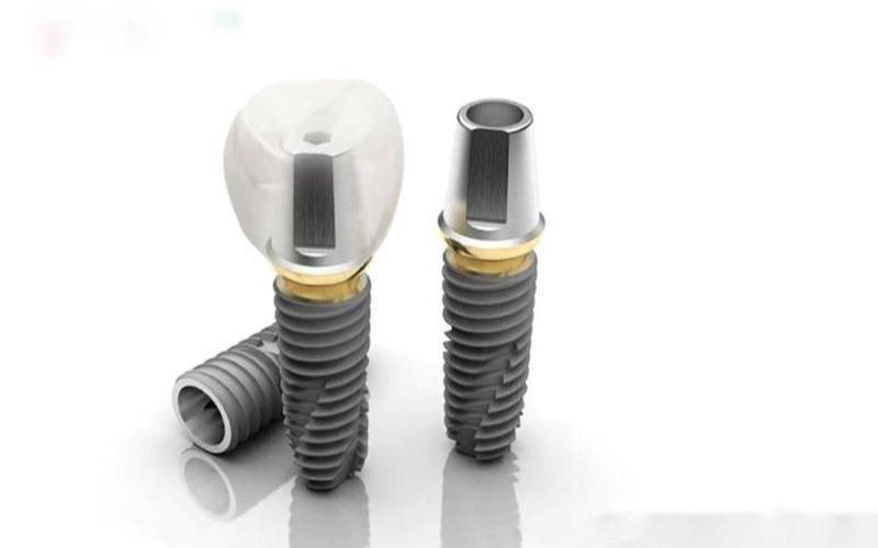 Trụ Implant Dentium Hàn Quốc đáp ứng tốt về độ bền và an toàn