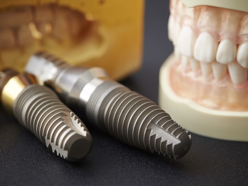 Trụ răng Implant được chế tác và sản xuất bởi chất liệu Titanium bền, nguyên chất