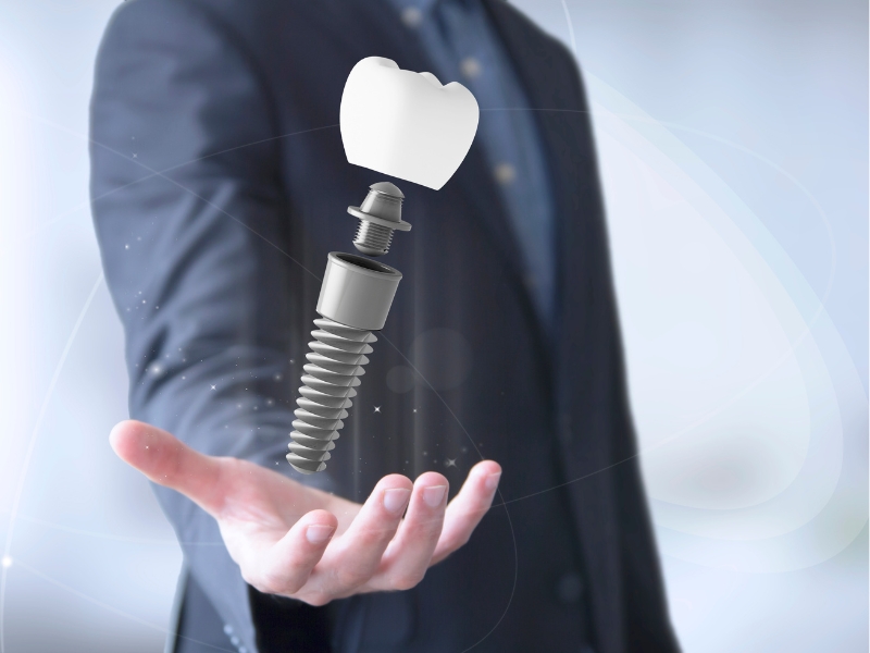 Trụ Implant Straumann Thuỵ sĩ có cấu tạo và giá cả ra sao?