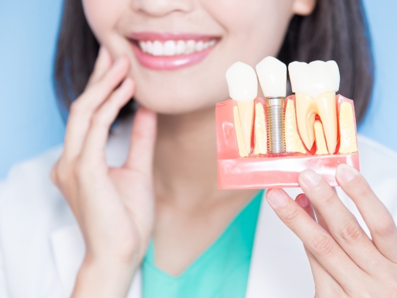 Chi phí thực hiện cấy ghép răng bằng trụ Implant phụ thuộc vào nhiều yếu tố khác